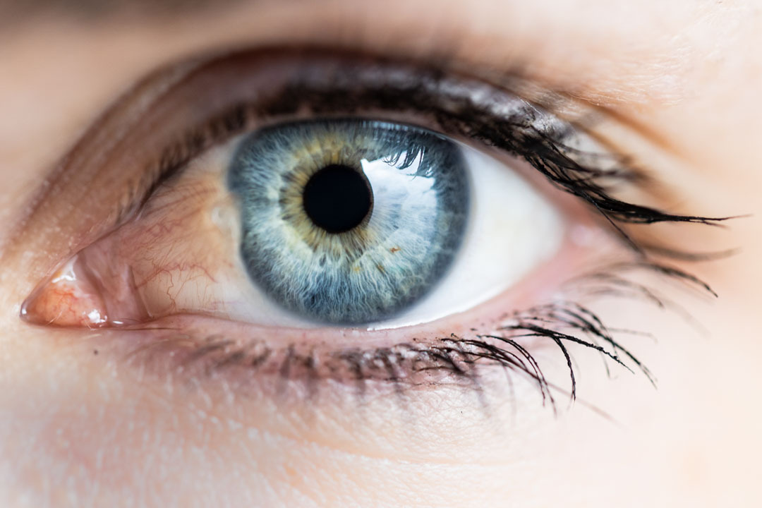 Pterígio no olho: o que é, causas e tratamentos