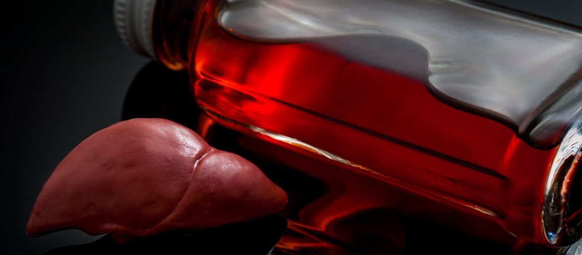 O que é gordura no fígado? Entenda as causas da esteatose hepática