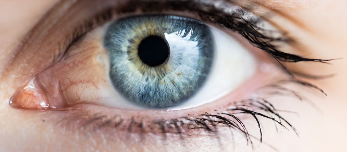 Pterígio no olho: o que é, causas e tratamentos