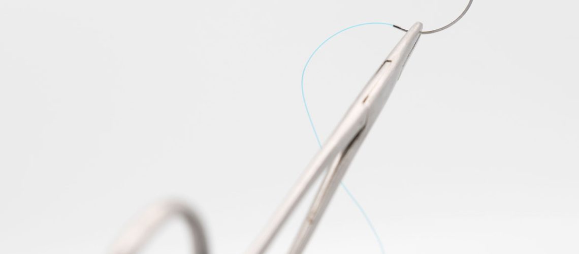 Videolaparoscopia: o que é e quando é indicada